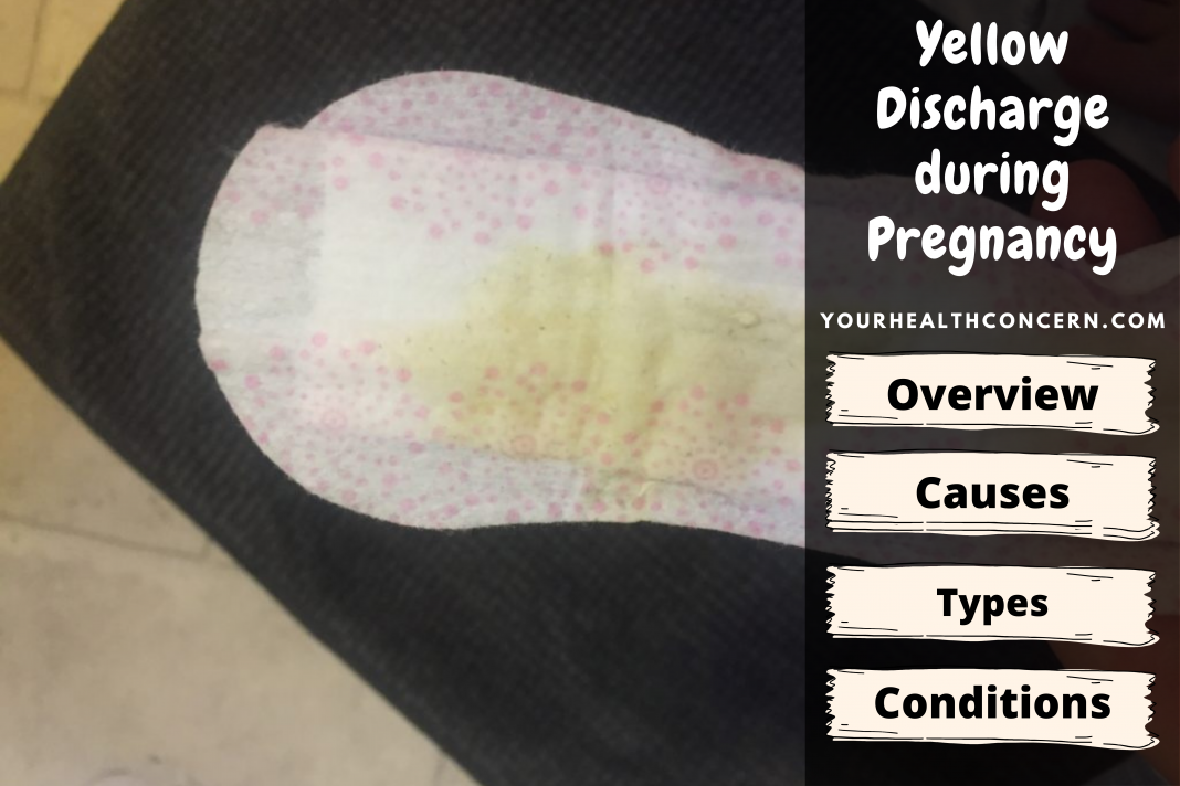 Yellow Discharge during Pregnancy