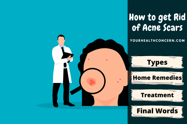 How to get Rid of Acne Scars Medically or at Home?
