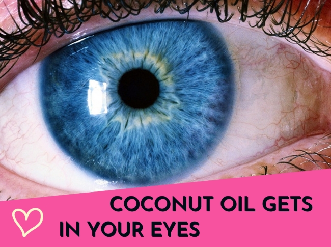 What Happens if Coconut Oil gets in your Eyes? Benefits of Coconut Oil